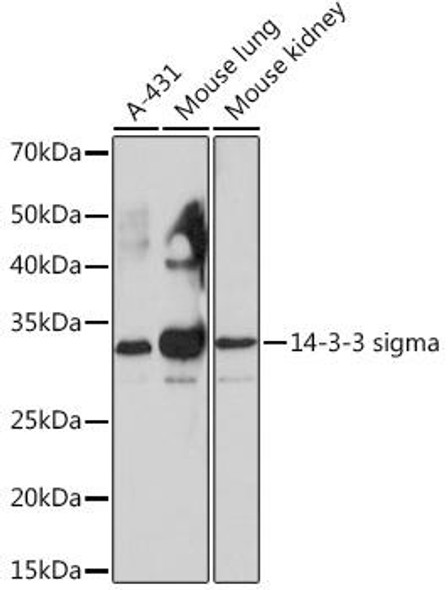 Anti-14-3-3 sigma Antibody (CAB4377)