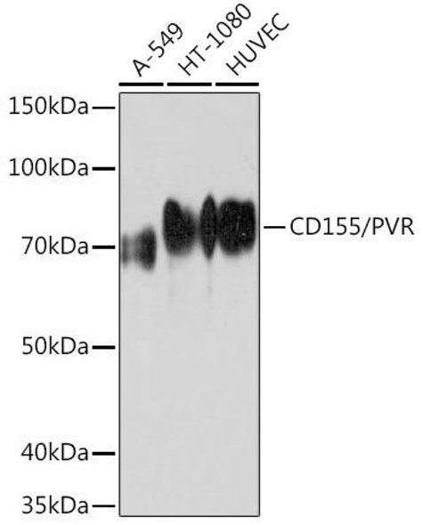 Anti-CD155/PVR Antibody (CAB5138)