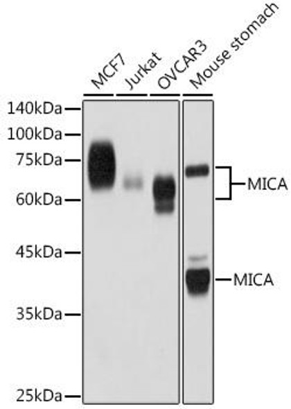 Anti-MICA Antibody (CAB19256)