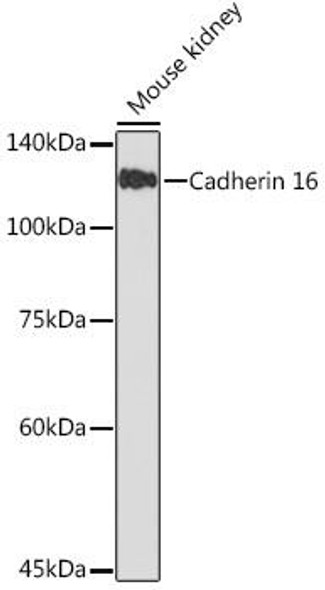 Anti-Cadherin 16 Antibody (CAB19644)