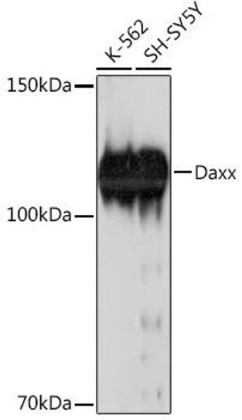 Anti-Daxx Antibody (CAB19661)