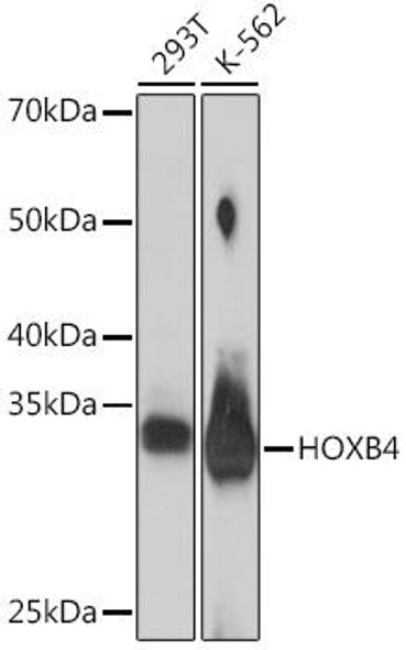 Anti-HOXB4 Antibody (CAB19699)