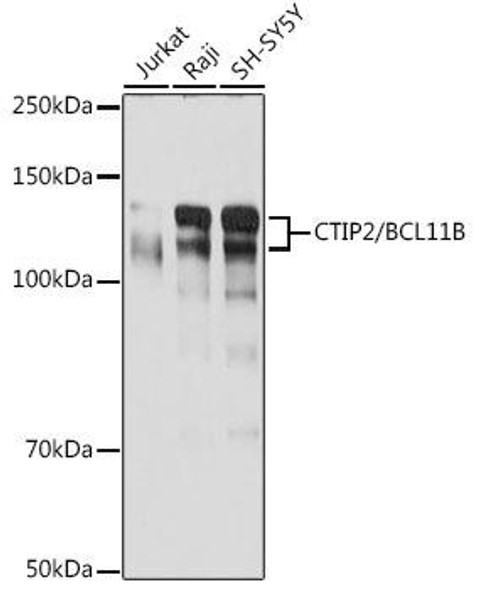 Anti-CTIP2/BCL11B Antibody (CAB19804)