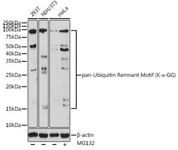 Anti-pan-Ubiquitin Remnant Motif (K-?-GG) Antibody (CAB20303)