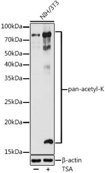 Anti-pan-acetyl-K Antibody (CAB20507)