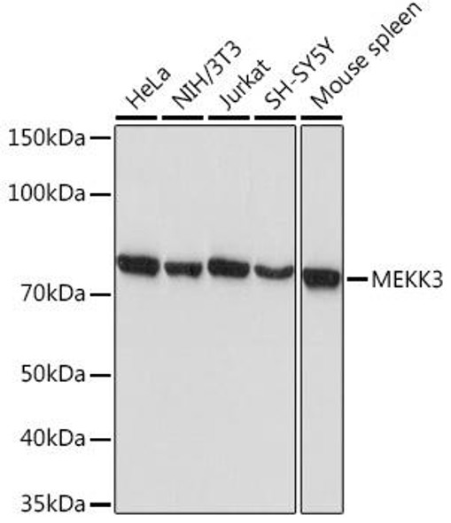 Anti-MEKK3 Antibody (CAB3695)