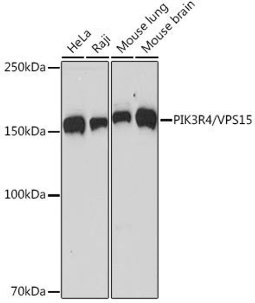 Anti-PIK3R4/VPS15 Antibody (CAB5922)