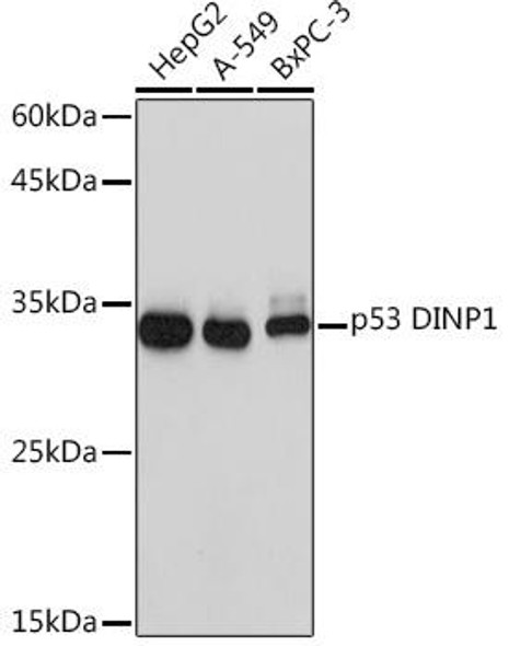 Anti-p53 DINP1 Antibody (CAB5952)