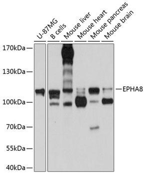 Anti-EPHA8 Antibody (CAB10213)