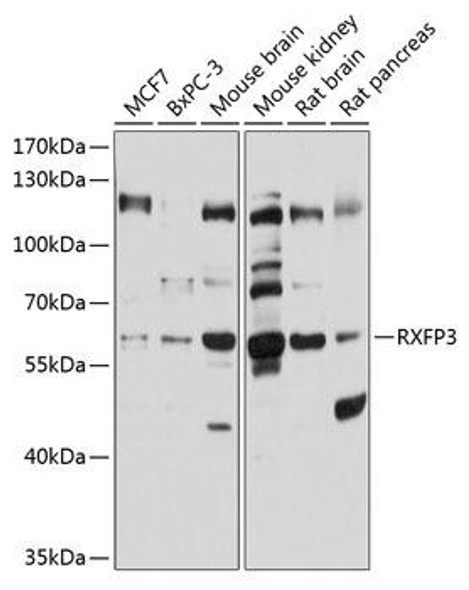 Anti-RXFP3 Antibody (CAB10303)