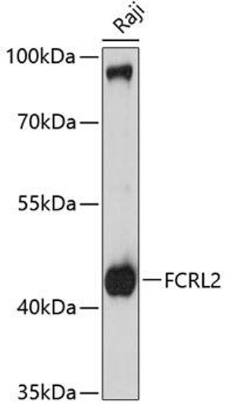Anti-FCRL2 Antibody (CAB10324)