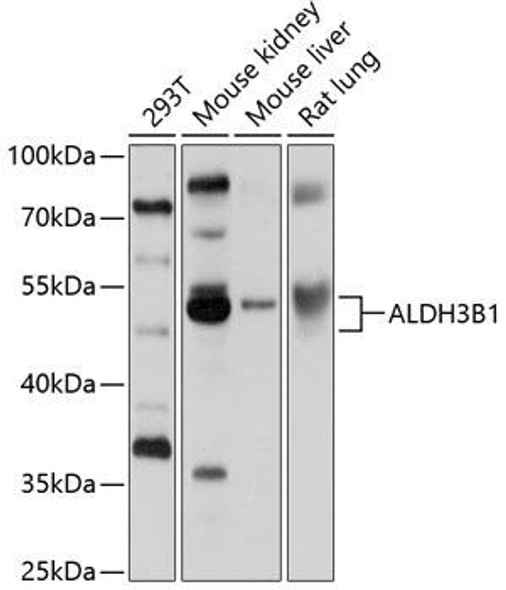 Anti-ALDH3B1 Antibody (CAB10415)