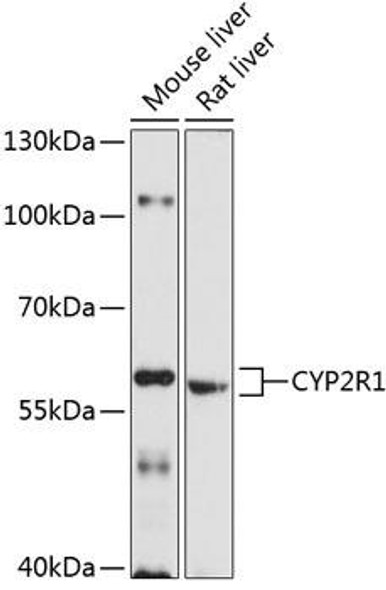 Anti-CYP2R1 Antibody (CAB10470)