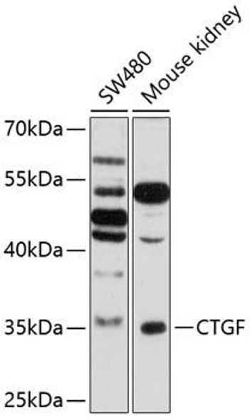 Anti-CTGF Antibody (CAB11456)