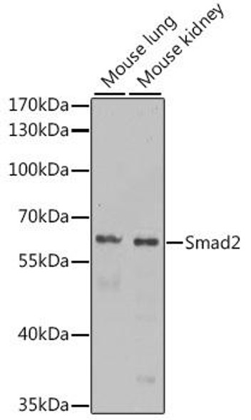 Anti-Smad2 Antibody (CAB11498)