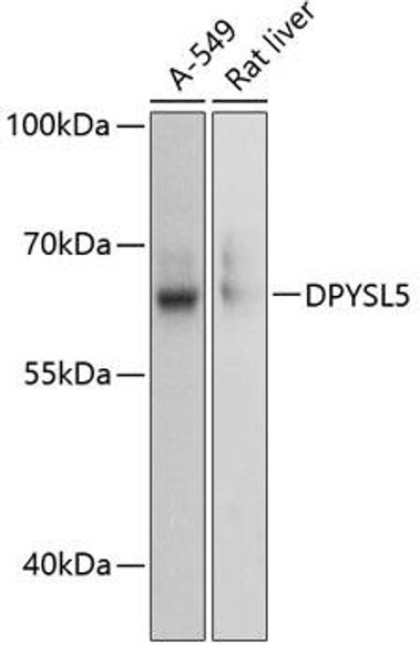 Anti-DPYSL5 Antibody (CAB13892)
