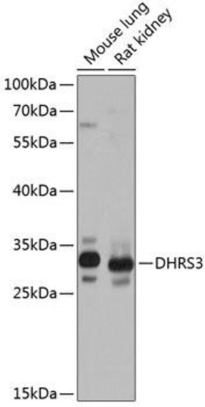 Anti-DHRS3 Antibody (CAB14172)
