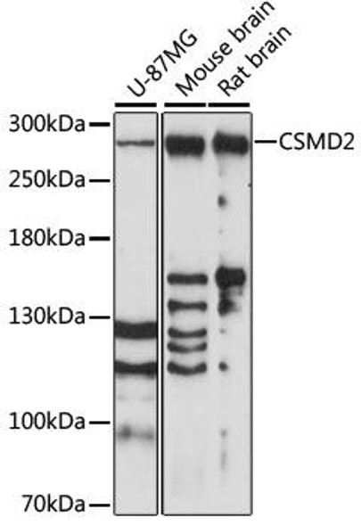 Anti-CSMD2 Antibody (CAB14229)