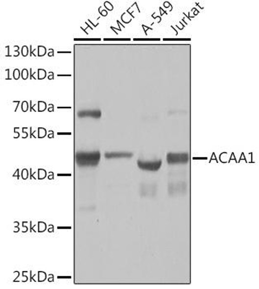Anti-ACAA1 Antibody (CAB14700)