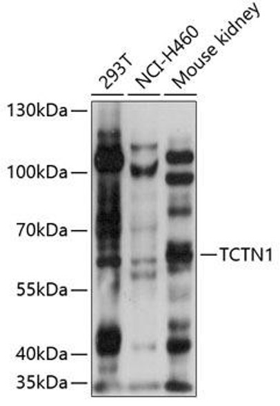 Anti-TCTN1 Antibody (CAB14929)