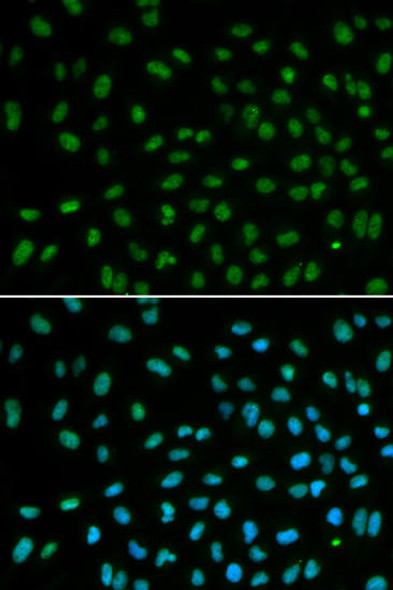 Anti-DDB2 Antibody (CAB1848)