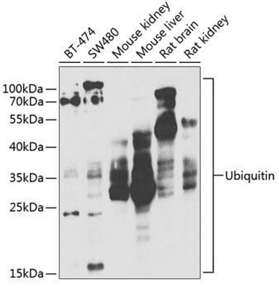 Anti-Ubiquitin Antibody (CAB2129)