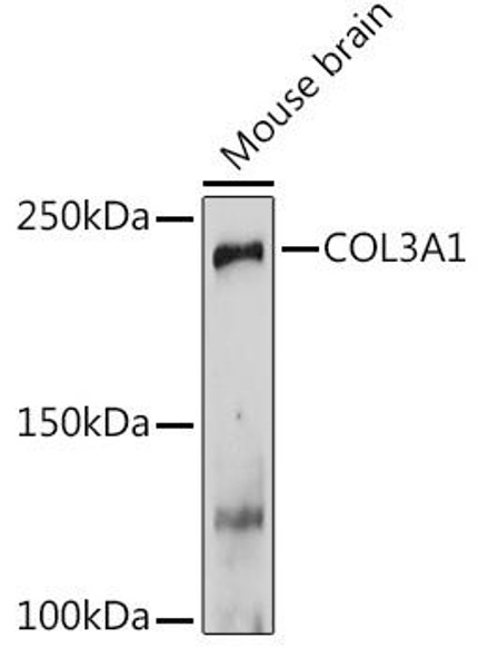 Anti-COL3A1 Antibody (CAB3795)