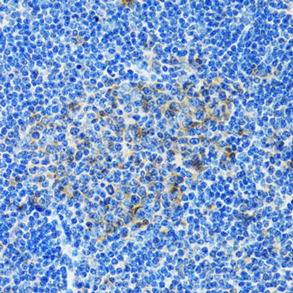 Anti-PAICS Antibody (CAB6450)