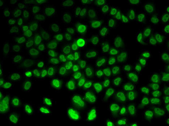 Anti-ASMT Antibody (CAB6529)