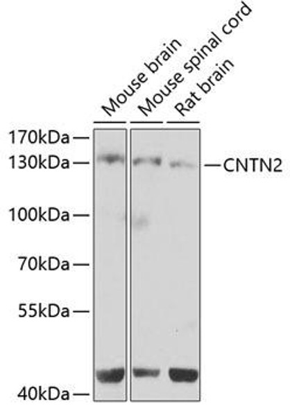 Anti-CNTN2 Antibody (CAB7738)