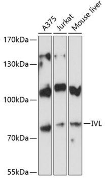 Anti-IVL Antibody (CAB8026)