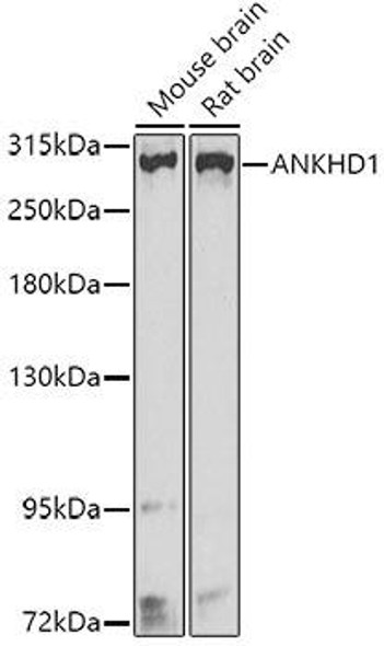 Anti-ANKHD1 Antibody (CAB8224)