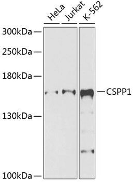 Anti-CSPP1 Antibody (CAB9983)