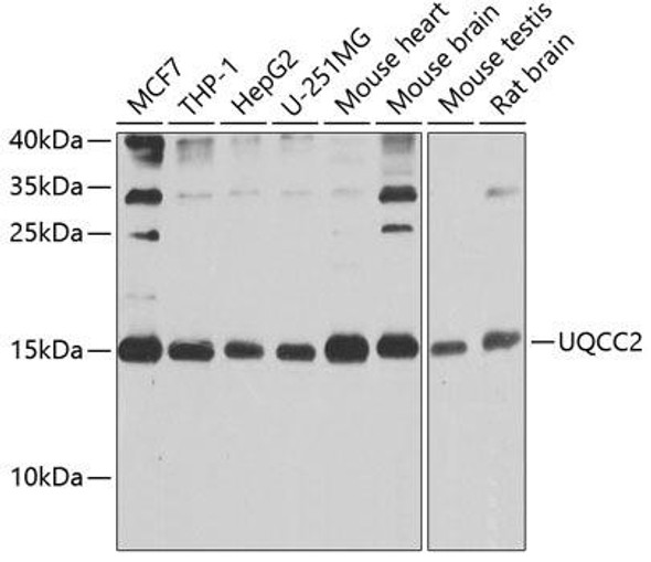 Anti-UQCC2 Antibody (CAB9986)