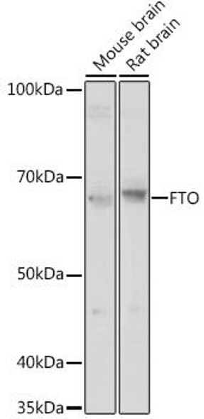 Anti-FTO Antibody (CAB18672)