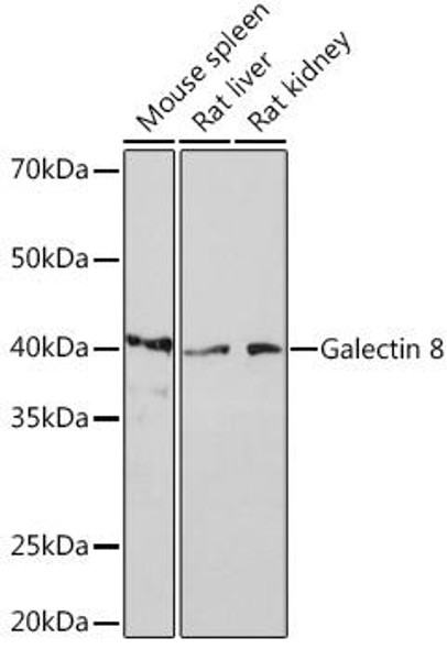 Anti-Galectin 8 Antibody (CAB4383)