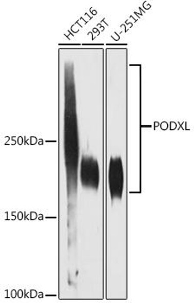 Anti-PODXL Antibody (CAB4554)