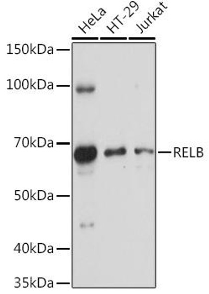 Anti-RELB Antibody (CAB0519)