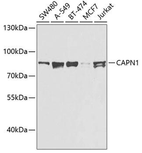 Anti-CAPN1 Antibody (CAB0921)