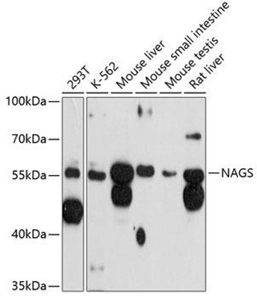 Anti-NAGS Antibody (CAB12086)