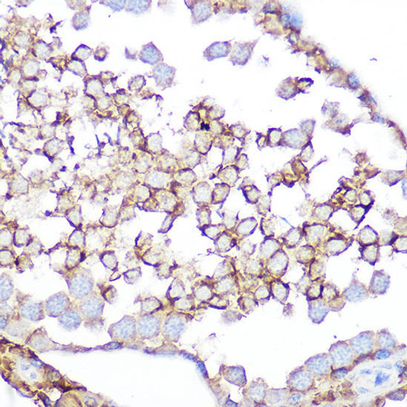 Anti-GPX4 Antibody (CAB13309)