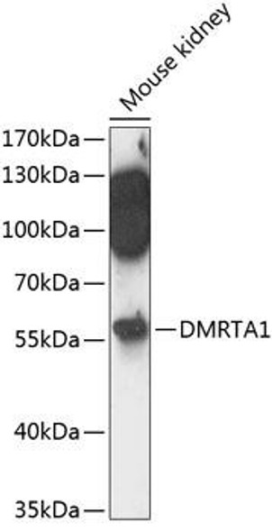 Anti-DMRTA1 Antibody (CAB14338)