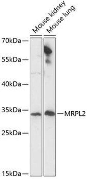 Anti-MRPL2 Antibody (CAB14404)