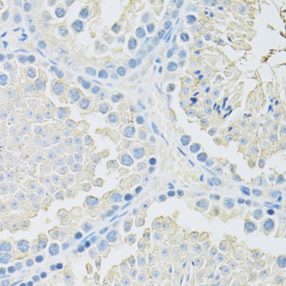 Anti-SLC2A9 Antibody (CAB14606)