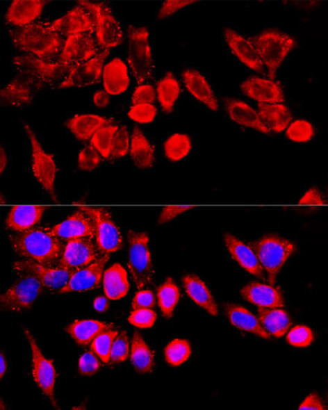 Anti-TRPC6 Antibody (CAB15107)