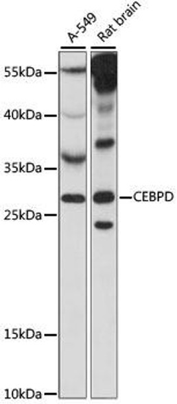 Anti-CEBPD Antibody (CAB15262)