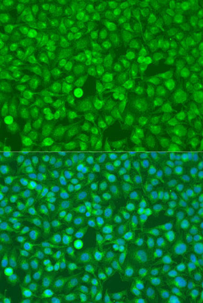 Anti-CSF3 Antibody (CAB15660)