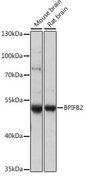 Anti-BPIFB2 Antibody (CAB16148)