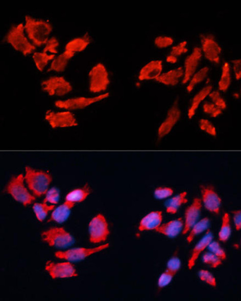 Anti-CA9 Antibody (CAB1658)