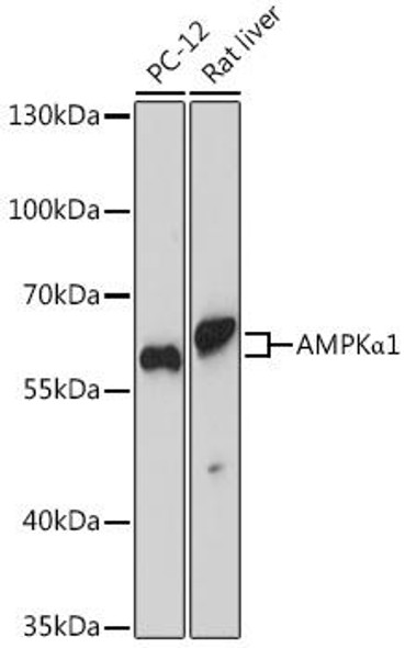 Anti-AMPKAlpha1 Antibody (CAB16656)